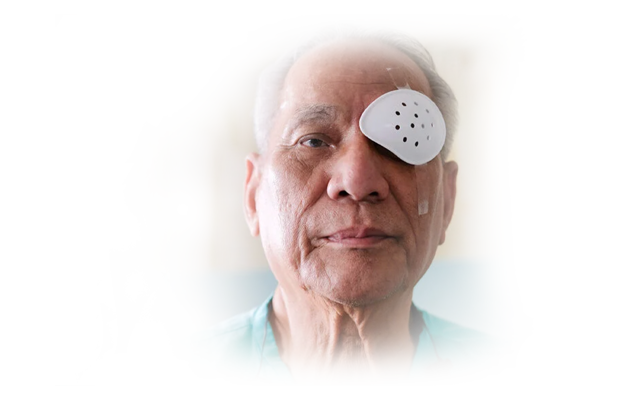 Image of a man who just had cataracts surgery and his left eye is covered