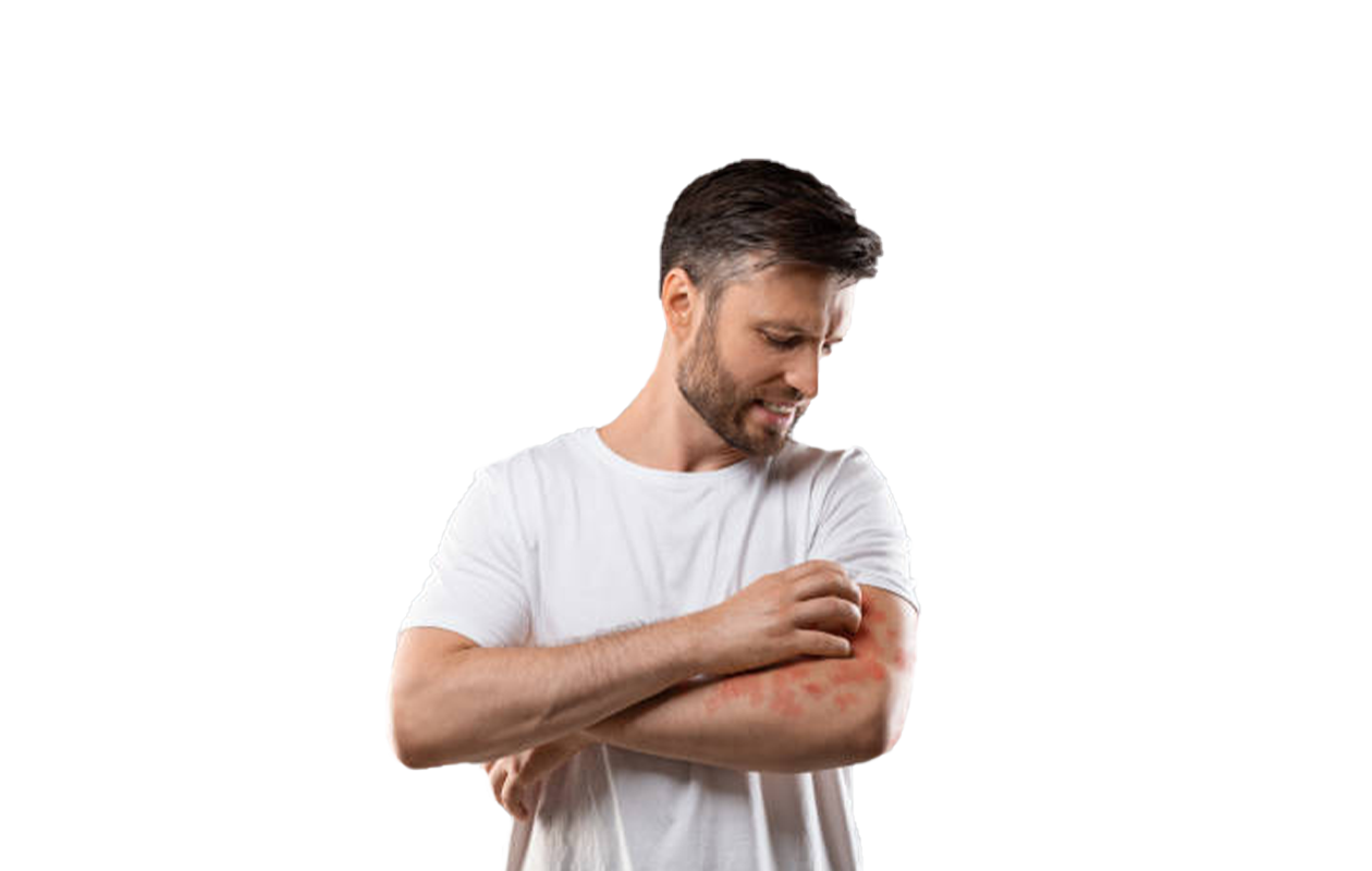 Photo of man scratching his arm where he has rash