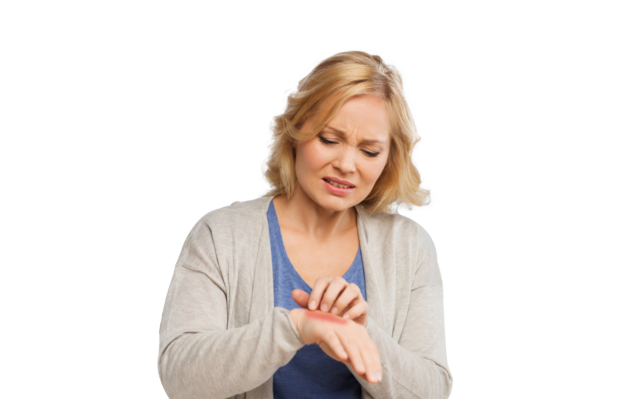 Image of woman scratching hand because of Scabies.