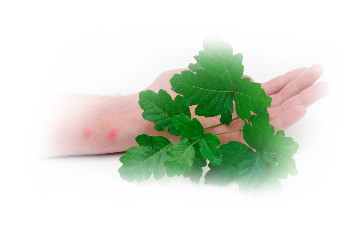 Image of poison ivy leaves with forearm in background with rash.