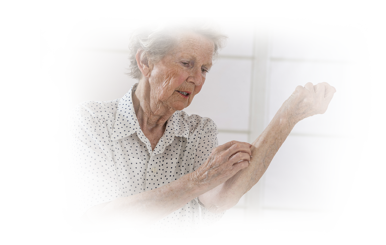 Image of older woman suffering from shingles scratching the inside of her forearm.