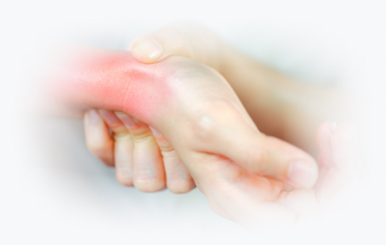 Image of person holding wrist that is red from inflammation
